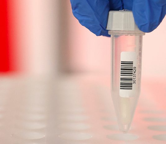 Test salivari, no di Cts e Ministero della Salute. L’azienda: “Non sono assolutamente un bluff”
