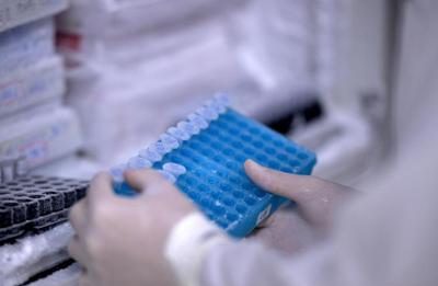 Scoperto il virus gigante Ushikuvirus, lo studio: “Può darci indizi su origine della vita”