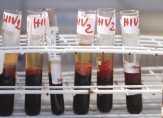 Hiv, Andreoni: “Terapie long acting migliorano aderenza e fermano trasmissione virus”