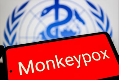 mpox_vaiolo_scimmie_tel_fg_ipa