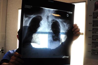 radiografia_fg