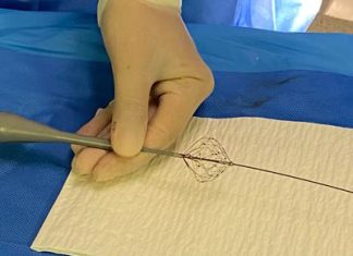 Fibrillazione atriale, Aou Marche: “Prima volta in Italia ablazione con catetere a campo pulsato”