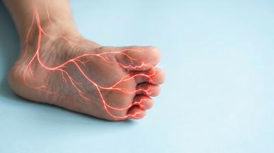 neuropatia_diabetica_adobe