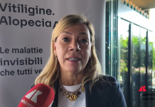 Cordella (AbbVie): “Vitiligine e alopecia siano riconosciute da Ssn”