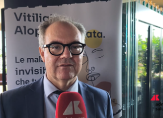 Costanzo (Sidemast): “Upadacitinib blocca cellule infiammatorie in vitiligine e alopecia areata”