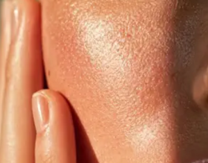 Ai, in Utah prescrizioni per l’acne via app senza intervento del medico