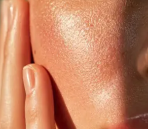 Ai, in Utah prescrizioni per l’acne via app senza intervento del medico