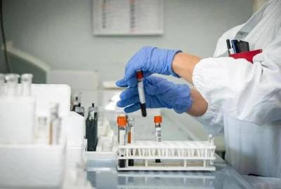 laboratorio_analisi_agenzia_fotogramma_fg_rit
