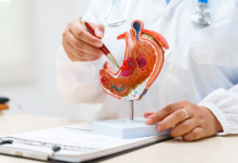 Cancro allo stomaco avanzato, nuova terapia riduce del 42% il rischio di morte 