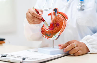 Cancro allo stomaco avanzato, nuova terapia riduce del 42% il rischio di morte 